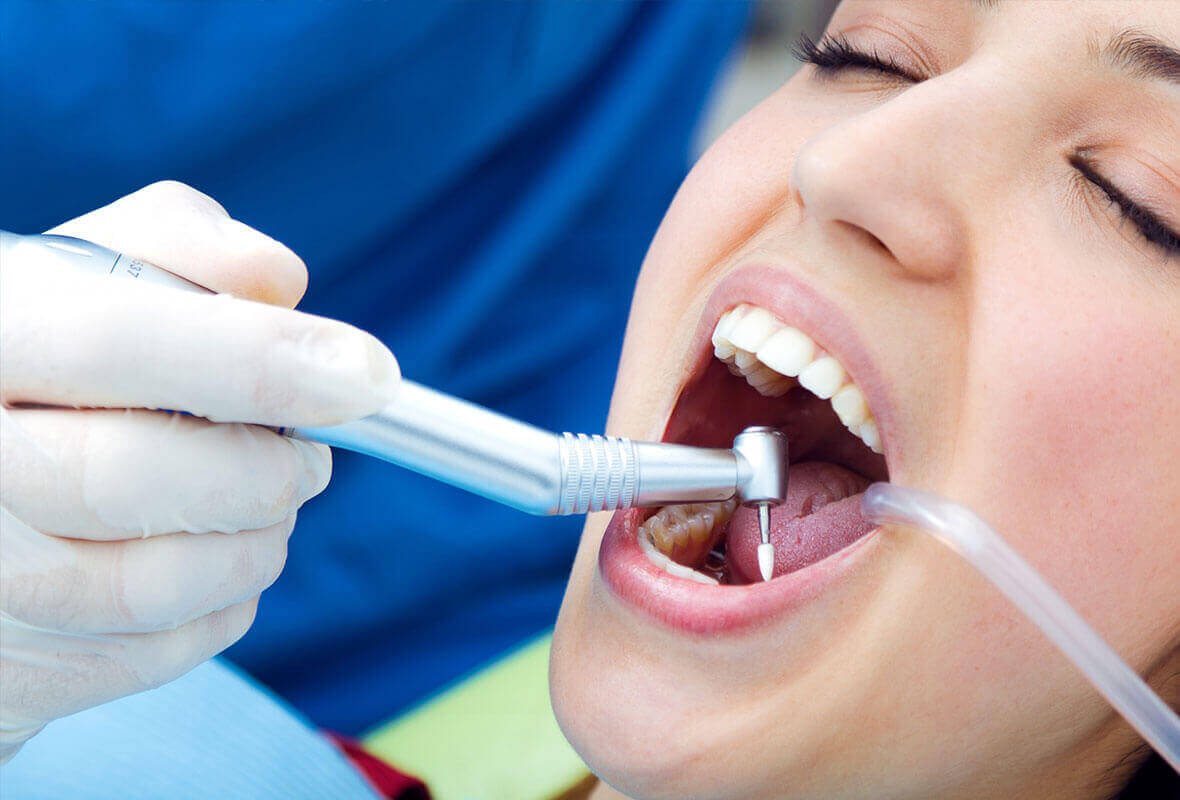 Laughter Gas: Solving Dental Anxiety in Children